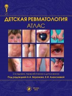 Детская ревматология. Атлас. 2-е издание